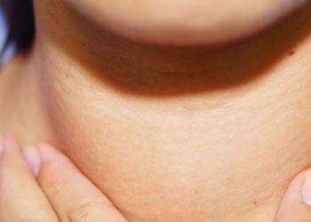 Csomó a nyakon - aspirációs citológia lehet szükséges 