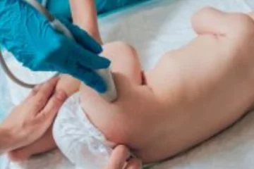 Nem csak tünetek esetén fontos a csecsemőkori ultrahang