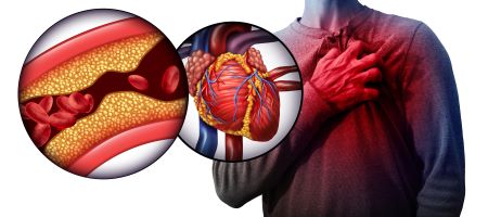 Nyaki ultrahanggal megelőzhető a szívinfarktus, a stroke.